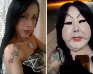《巴西女整形失敗》募款救臉 結局出爐全網「三條線」 讓她淚崩做一件事