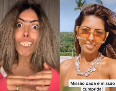 【閱覽注意】《巴西暴牙女整牙前後對比》我就在想那是不是牙套,果然...