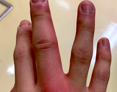 《空手給女生◯◯的結果》一夕之間練成猛毒手 別以為只有啪啪啪才要戴防護用具