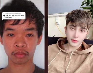 越南醜男求職失敗 整形成《韓系歐巴》帥到連父母都認不得