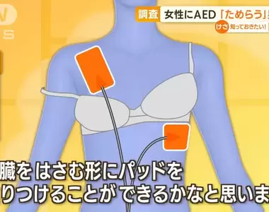 《男性不敢對女性施以AED急救問題》救人的時候會有顧慮，到底該不該出手救助呢？