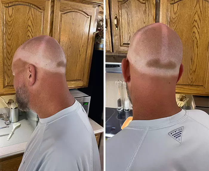 炎炎夏日各種《不塗防曬的結果》網友分享身體上的誇張色差