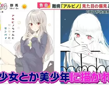 《白化症患者吐槽二次元》動漫裡的白化症都是美少年美少女?害她從小總是莫名被嫌醜