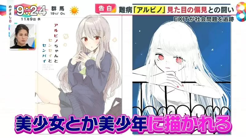 《白化症患者吐槽二次元》動漫裡的白化症都是美少年美少女?害她從小總是莫名被嫌醜 《白化症患者吐槽二次元》動漫裡的白化症都是美少年美少女?害她從小總是莫名被嫌醜