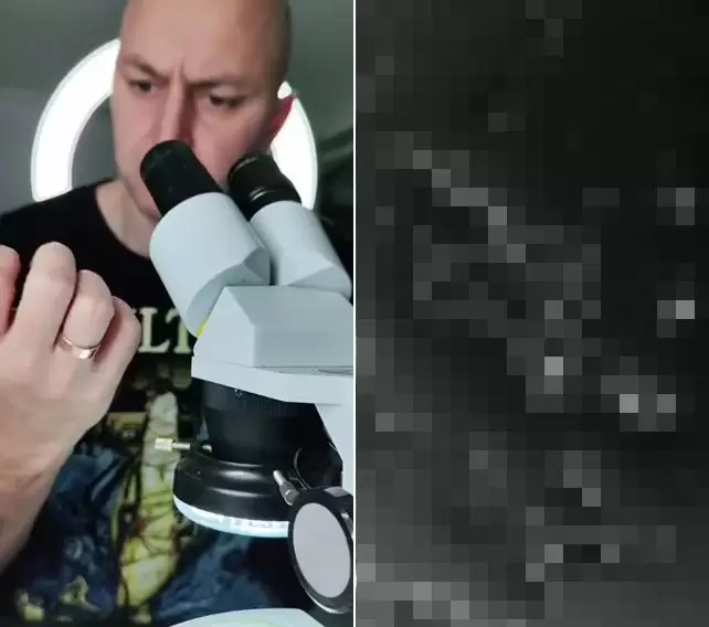 《用顯微鏡看指甲垢的結果》喜歡咬指甲的朋友該注意一下囉