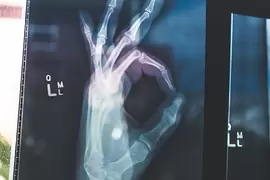 《讓人忍不住盯著看的X光照片》充滿難以想像的各種畫面 《讓人忍不住盯著看的X光照片》充滿難以想像的各種畫面