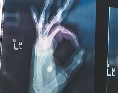 《讓人忍不住盯著看的X光照片》充滿難以想像的各種畫面