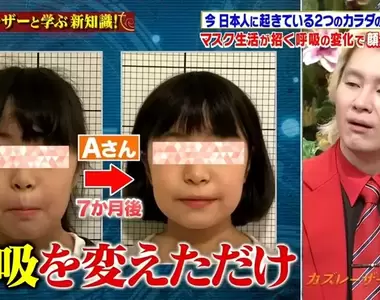 《疫情戴口罩的意外變化》習慣用嘴呼吸導致臉部塌陷?跟著醫生檢查你有沒有這種問題