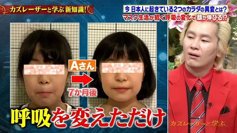 《疫情戴口罩的意外變化》習慣用嘴呼吸導致臉部塌陷？跟著醫生檢查你有沒有這種問題