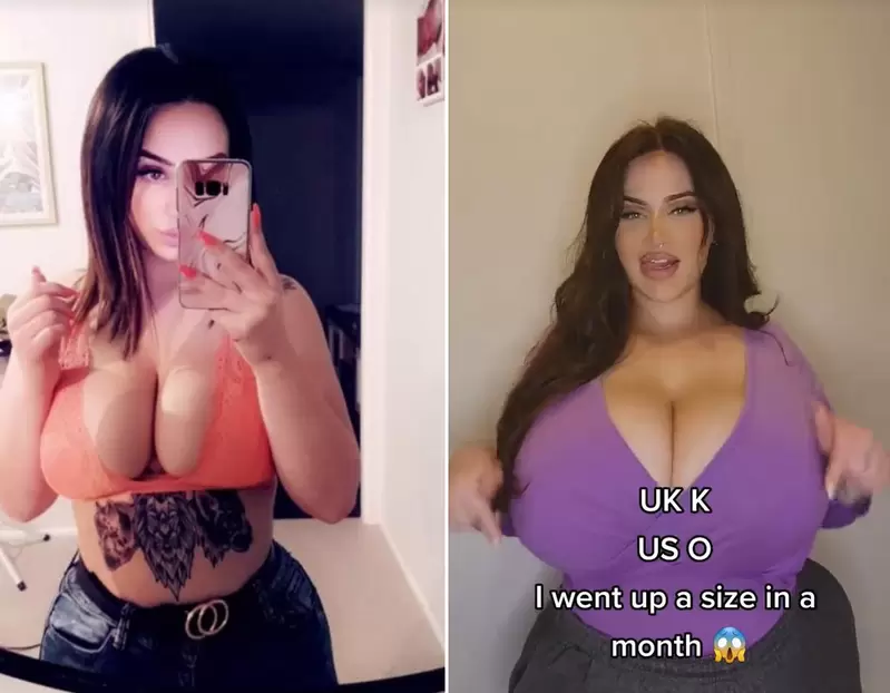 巨乳太大扛不住《女網美罹患巨乳症》一年可以往上漲六個罩杯 巨乳太大扛不住《女網美罹患巨乳症》一年可以往上漲六個罩杯