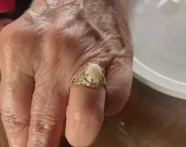 百萬分之一的機率《吃海鮮吃出一顆珍珠》之後更直接拿來做成戒指求婚