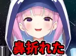 《醫生:不要躺著滑手機》砸到鼻子骨折還要動手術 VTuber湊阿庫婭也因此受過傷 《醫生:不要躺著滑手機》砸到鼻子骨折還要動手術 VTuber湊阿庫婭也因此受過傷
