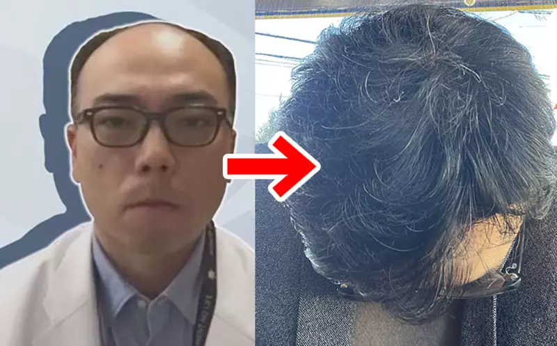 《禿頭醫生大變身》新冠疫情期間推廣疫苗被罵爆 拿勝訴賠償金生髮變得超濃密 《禿頭醫生大變身》新冠疫情期間推廣疫苗被罵爆 拿勝訴賠償金生髮變得超濃密