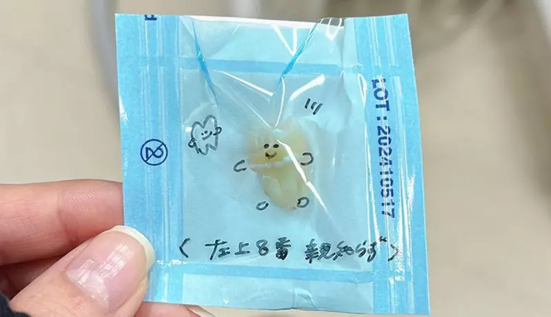 喜歡上看牙醫的網友 拔掉的智齒還會被好好的包裝起來敲用心❤ 喜歡上看牙醫的網友 拔掉的智齒還會被好好的包裝起來敲用心❤