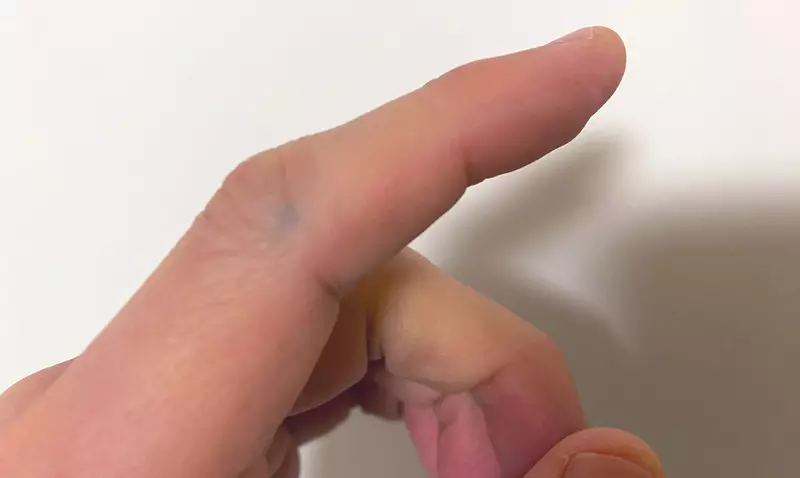 《鉛筆芯卡進手裡的人》有類似經驗的人出乎意料多?聲優坂巻學想找大家開網聚 《鉛筆芯卡進手裡的人》有類似經驗的人出乎意料多?聲優坂巻學想找大家開網聚