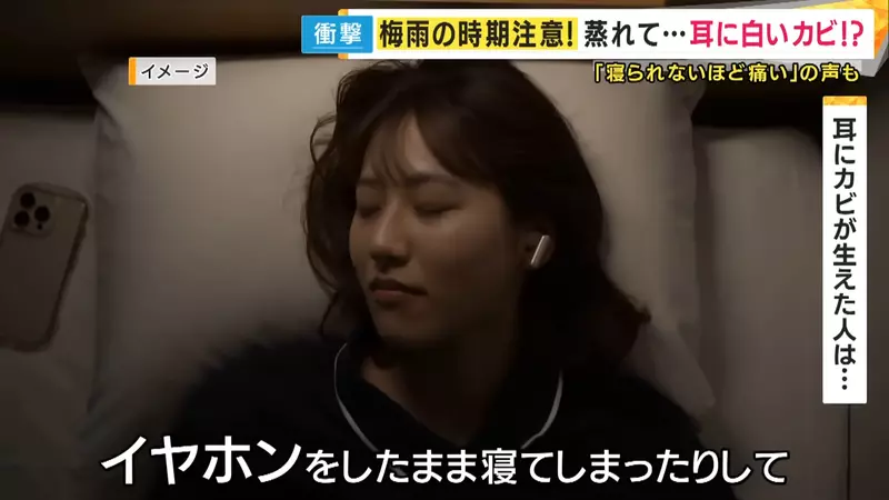 《夏天耳機戴太久的後果》日本年輕人戴耳機睡覺 竟然讓耳道裡面發霉了