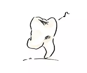 網友分享《關於我智齒太過可愛這件事》這樣子就像是自己從牙槽跑出來的這樣(笑)