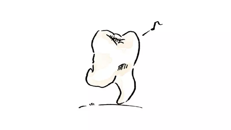 網友分享《關於我智齒太過可愛這件事》這樣子就像是自己從牙槽跑出來的這樣(笑)