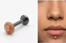 《青春痘穿孔飾品》潮不潮不知道？但別人看到應該會想幫你擠？