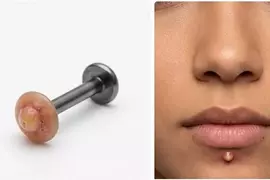 《青春痘穿孔飾品》潮不潮不知道？但別人看到應該會想幫你擠？