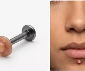 《青春痘穿孔飾品》潮不潮不知道？但別人看到應該會想幫你擠？