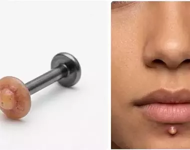 《青春痘穿孔飾品》潮不潮不知道？但別人看到應該會想幫你擠？