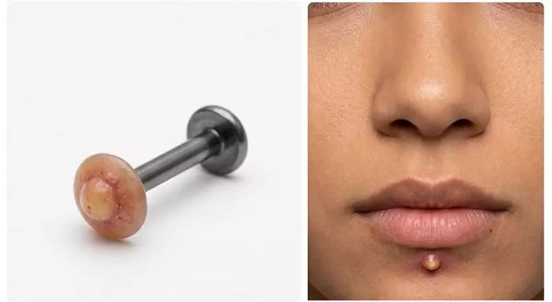 《青春痘穿孔飾品》潮不潮不知道？但別人看到應該會想幫你擠？