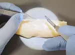 外科醫生處理雞柳條上的筋膜 以完全手術規格去除的影片吸引無數網友觀看