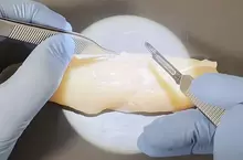 外科醫生處理雞柳條上的筋膜 以完全手術規格去除的影片吸引無數網友觀看