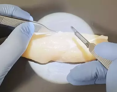 外科醫生處理雞柳條上的筋膜 以完全手術規格去除的影片吸引無數網友觀看