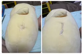 當外科醫生看到玩偶破損時馬上實施縫合 這時覺得自己能身為醫師第一時間處理真是太好了