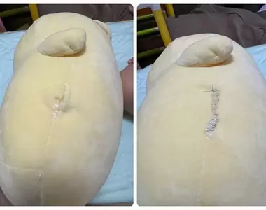 當外科醫生看到玩偶破損時馬上實施縫合 這時覺得自己能身為醫師第一時間處理真是太好了